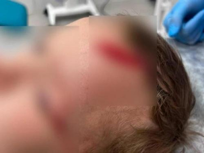 Пёс рвал голову ребёнку, а хозяин стоял и смотрел: на внука Дарьи Донцовой напала собака, писательница требует наказать виновного
